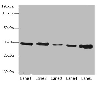 UCP3 Polyclonal Antibody
