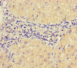 VAMP1 Polyclonal Antibody