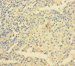 VAMP5 Polyclonal Antibody