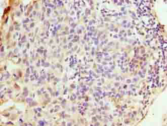 WDR62 Polyclonal Antibody