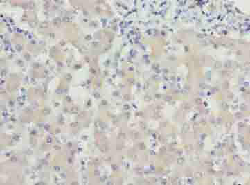 WDR91 Polyclonal Antibody
