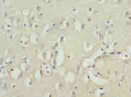 ZNF177 Polyclonal Antibody