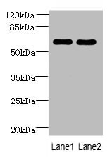 ZNF215 Polyclonal Antibody