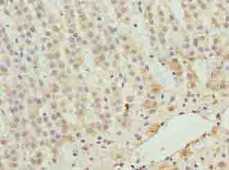 ZNF226 Polyclonal Antibody