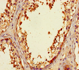 ZNF230 Polyclonal Antibody