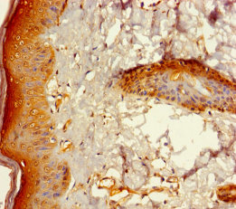 ZNF260 Polyclonal Antibody