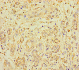 ZNF287 Polyclonal Antibody