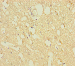 ZNF396 Polyclonal Antibody