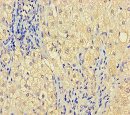 ZNF404 Polyclonal Antibody