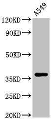 ZNF488 Polyclonal Antibody