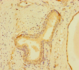 ZNF560 Polyclonal Antibody