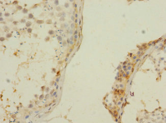 ZNF564 Polyclonal Antibody
