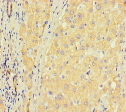 ZNF583 Polyclonal Antibody