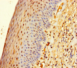 ZNF586 Polyclonal Antibody