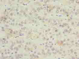 ZNF622 Polyclonal Antibody