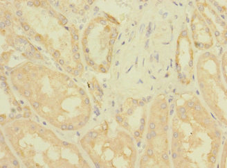 ZNF624 Polyclonal Antibody