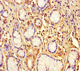 ZNF627 Polyclonal Antibody