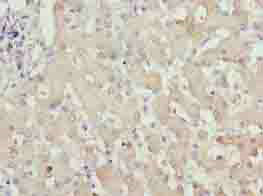 ZFP69B Polyclonal Antibody