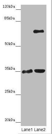 ZNF75A Polyclonal Antibody