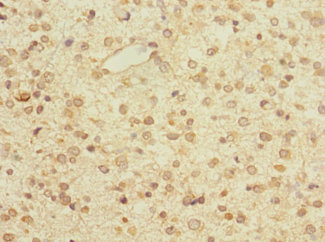 ZNF774 Polyclonal Antibody