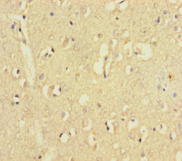 ZNF800 Polyclonal Antibody