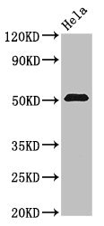ZNF829 Polyclonal Antibody