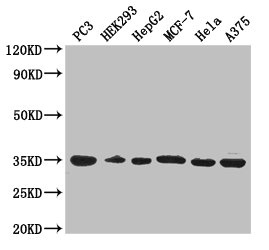 COPE Polyclonal Antibody