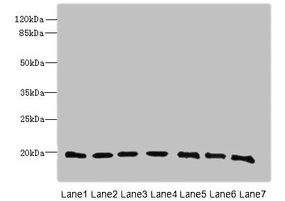 PARK7 Polyclonal Antibody