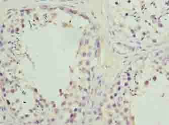 Immunohistochemistry of paraffin-embedded human testis tissue using PARK7 Polyclonal Antibody at dilution of 1:100.