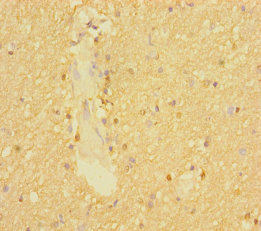 SLC6A7 Polyclonal Antibody