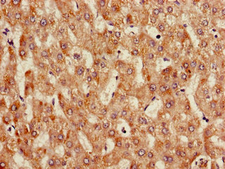 ANGPTL3 Polyclonal Antibody (50 µl)