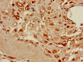 DKK1 Polyclonal Antibody