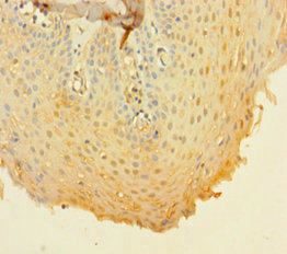 CD14 Polyclonal Antibody