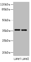 Thpo Polyclonal Antibody