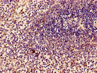 MYL2 Polyclonal Antibody