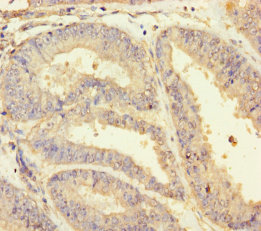 HSPA12B Polyclonal Antibody