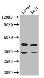 BHMT2 Polyclonal Antibody