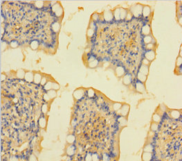 Immunohistochemistry of paraffin-embedded human small intestine tissue at dilution 1:100