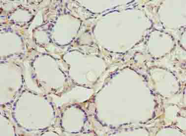 CMC4 Polyclonal Antibody