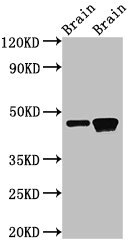 GNAS Polyclonal Antibody