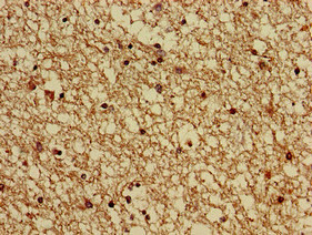 Immunohistochemistry of paraffin-embedded human brain tissue using GNAS Polyclonal Antibody at dilution of 1:100.