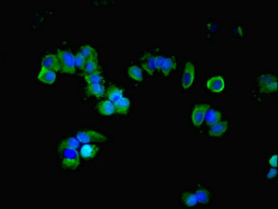 Immunofluorescent analysis of MCF-7 cells using GNAS Polyclonal Antibody at a dilution of 1:100 and Alexa Fluor 488-congugated AffiniPure Goat Anti-Rabbit IgG (H+L).
