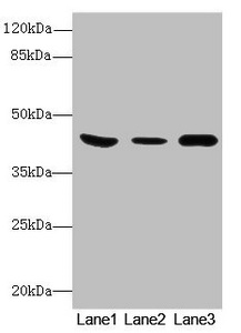 B4GALT5 Polyclonal Antibody