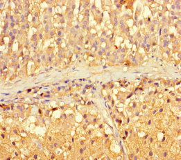 ARL16 Polyclonal Antibody