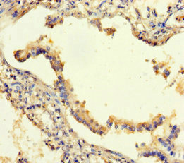 SEMA5A Polyclonal Antibody
