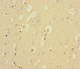 KCNMA1 Polyclonal Antibody