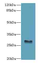 GPM6B Polyclonal Antibody