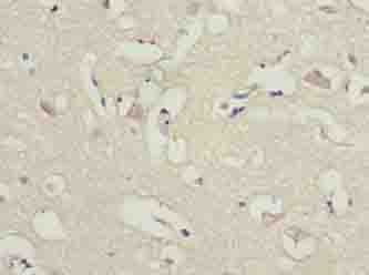 ARL6IP1 Polyclonal Antibody