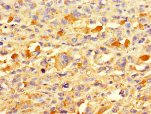 TAF13 Polyclonal Antibody