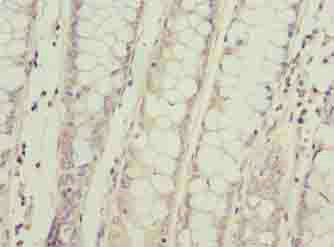 SPCS2 Polyclonal Antibody